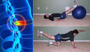 حرکات اصلاحی دیسک کمر درمان بیرون زدگی و فتق دیسک کمر با ورزش
