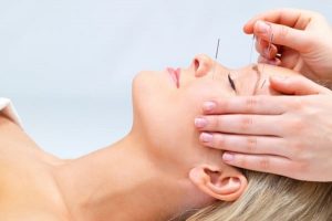 کاربرد و مزایای استفاده از طب سوزنی در درمان بیماری های اسکلتی عضلانی